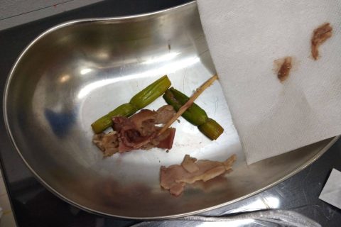 誤食・誤飲したもの